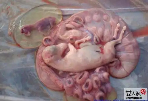 人胎盘片的功效与作用你不知道的营养价值