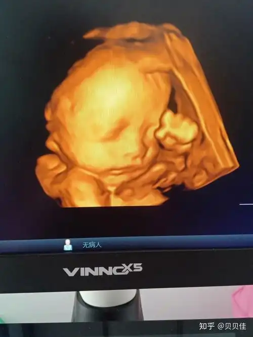 四维彩超看到可爱的她正在揉眼睛