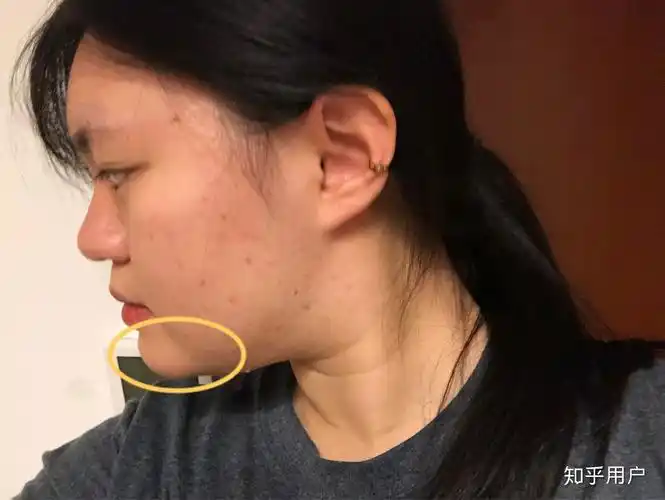 下巴太翘了怎么办? - 知乎