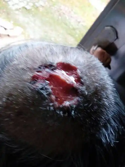 头皮都烂成这样了,怎么能治好,不动手术只用于药,是什么原因造成的,这