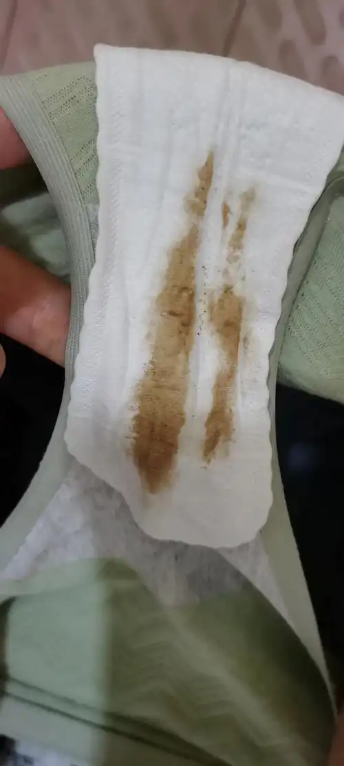 你们也是这样的吗排卵期出血附上图片