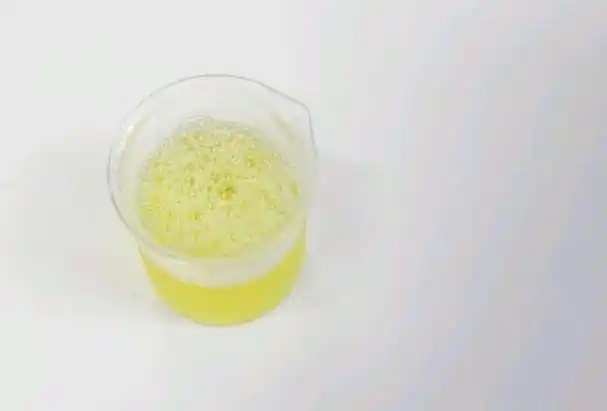 尿液为什么会变色