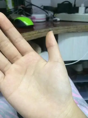 手相没有生命线 手相两条线不相交