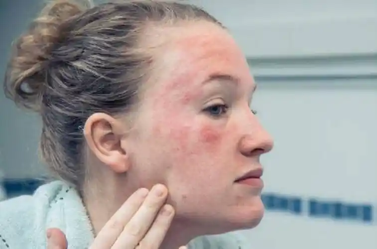 让皮肤变差的3种护肤方式,真的,你还不如只用清水洗脸