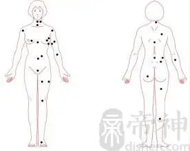 女性后背上的吉痣与凶痣解析 背部痣相解析