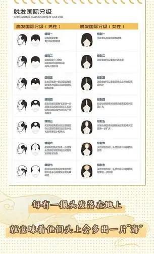 2020脱发等级对照表