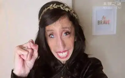 最恶心的图片集合:世界上又丑又恶心的男人和女人