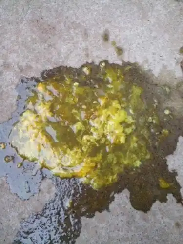 我女儿70天了,今天拉了5次了,如图,吃完奶就吐,吃什么药?