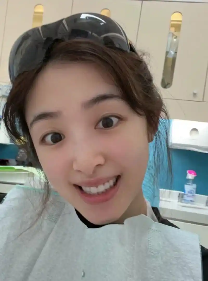 张含韵一时冲动做了冷光牙齿美白,完成之后直呼太疼了,她晒出当时在