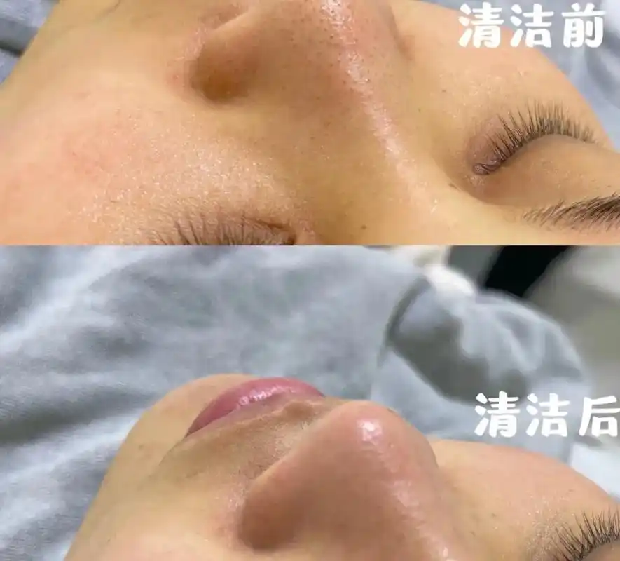 脸部温和深层清洁77面部按摩spa77玉石种.