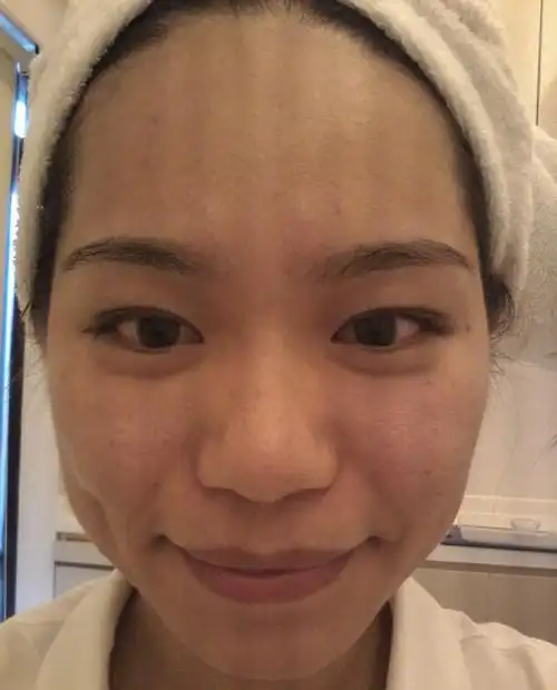 1/8 25岁女人熬夜多皮肤暗黄显老态,苹果加点它,帮你美白提亮肌肤