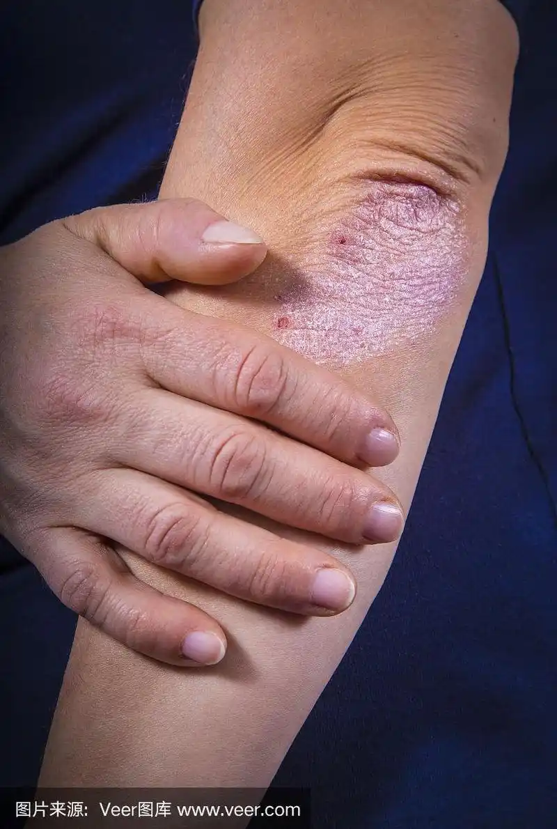 肘,牛皮廯,垂直画幅,四肢,干的