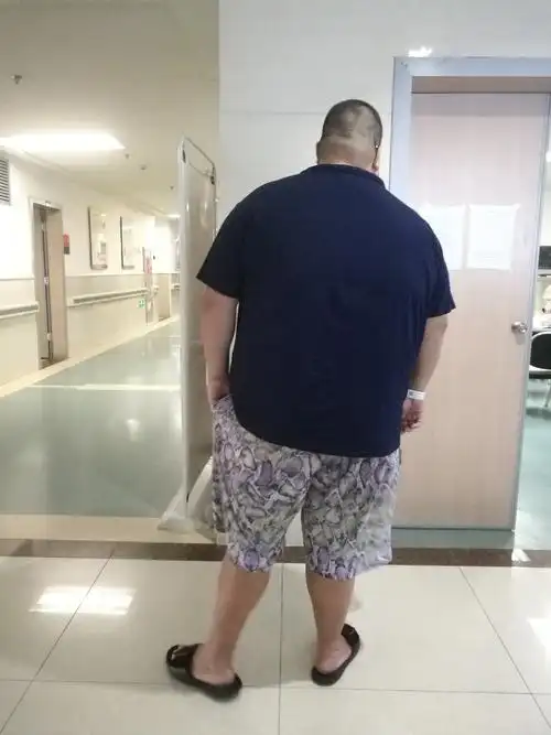 一年胖了180斤是怎样的体验比肥胖更难过的是白眼