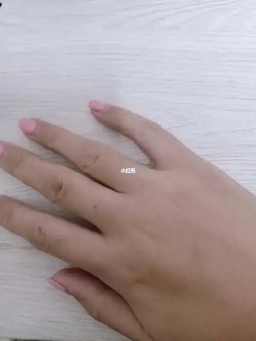 右虎口和右中指根有痣