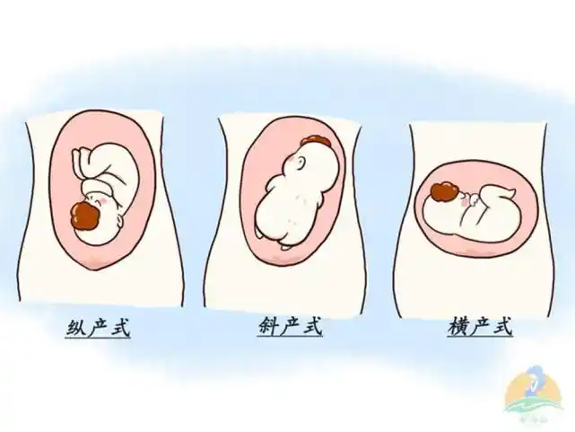 遇上胎位不正的情况,这些纠正方法,孕妈们可以了解一下