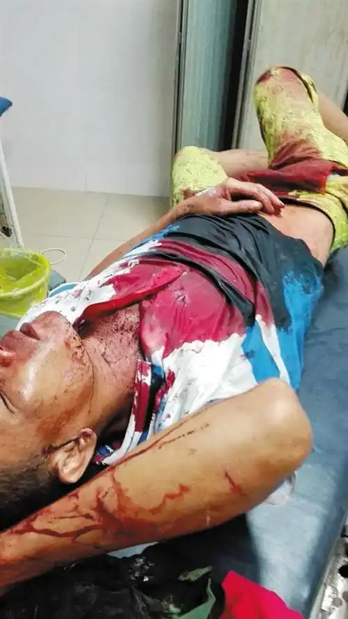 男子被多名蒙面人砍伤