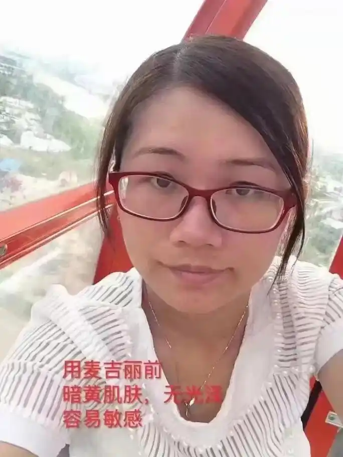 皮肤暗黄无光泽,还毛孔粗大,容易敏感,肤色不匀,这是一位顾客 - 抖音