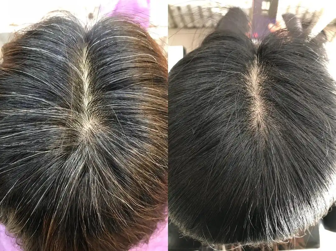 青丝百年白发转黑 - 抖音