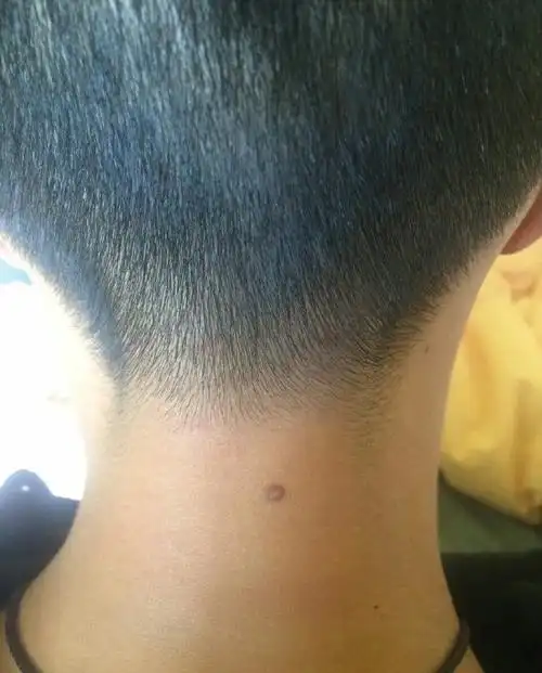 痣相图解:脖子上长痣-搜狐