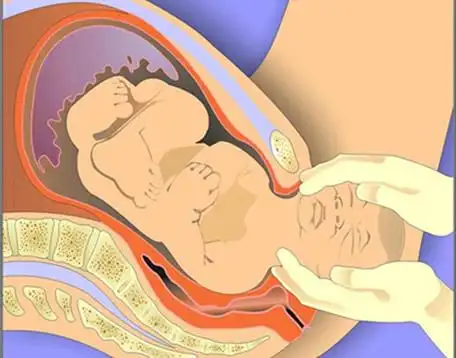 来听听!代生孩子过程"注意事项"-第1张图片-玫红博客