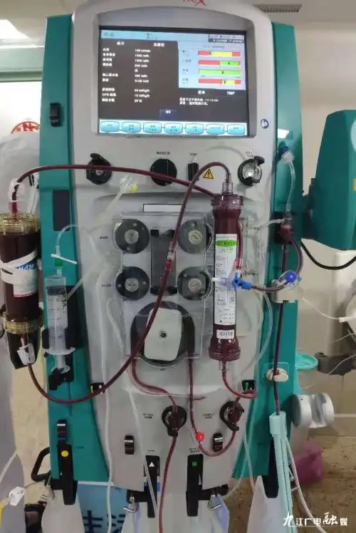 中毒多器官功能衰竭患者顺利开展了cvvhdf-hp(血液滤过-透析-灌流)