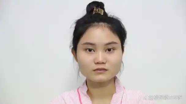 那些大方脸并且做了面部磨骨的人,现在都长什么样?