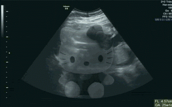 我怀孕了套路表情包:搞笑b超图