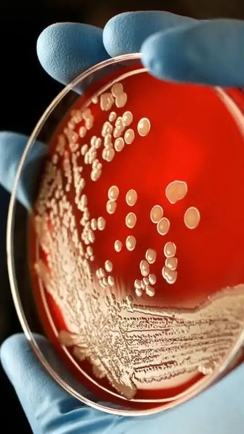 显微镜下的黄色葡萄糖球菌