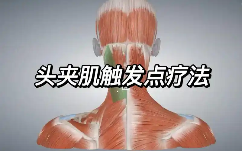 头夹肌解剖及触发点疗法