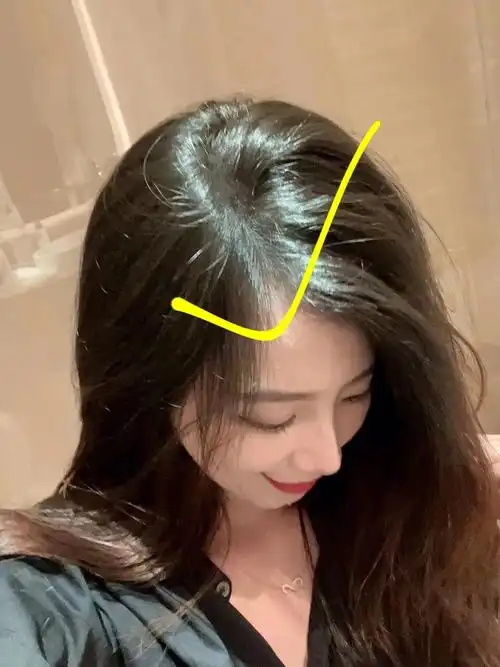 宽  头发哪儿也是油的很快的95 还有个不太好的习惯 喜欢用手捋头发