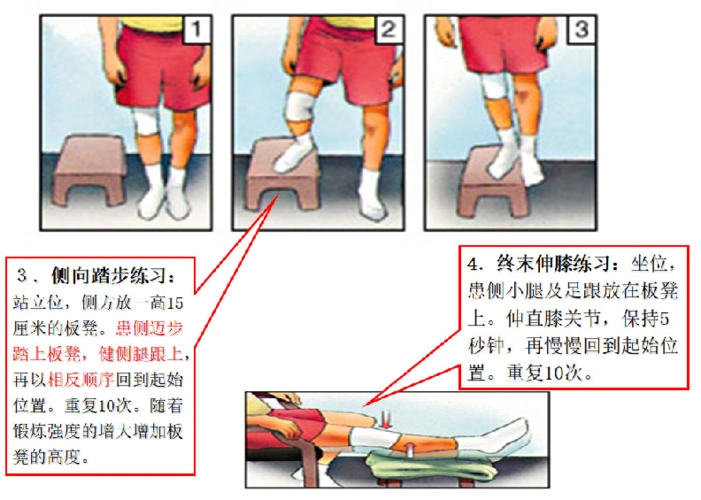 膝关节前交叉韧带损伤术后康复