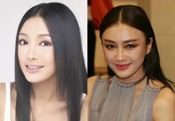 整容这事要看底子,秦岚原本底子就很好,之前也说过,跟蒋勤勤一样属于