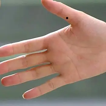 手上长痣有什么含义