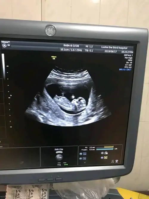 nt照片都是这样的吗