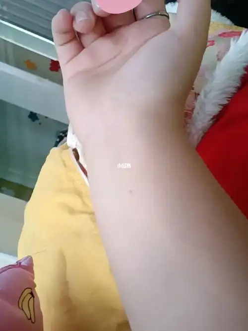 右手腕突然长个痣 是啥意思?#痣  #命运