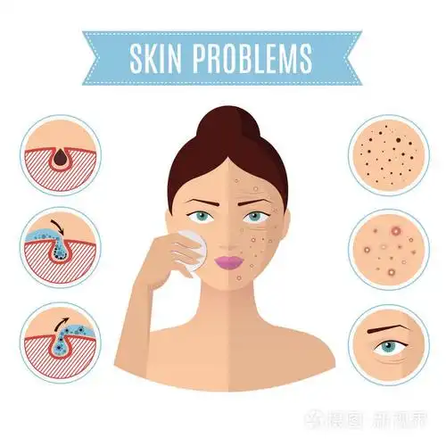 皮肤问题解决, 痤疮治疗和清洁毛孔完人脸矢量图标