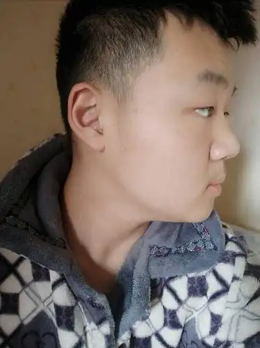 侧脸难看帮忙看看哪里有缺陷