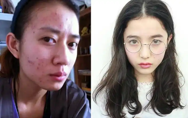 皮肤好和皮肤差的女生,护肤差在这几点!