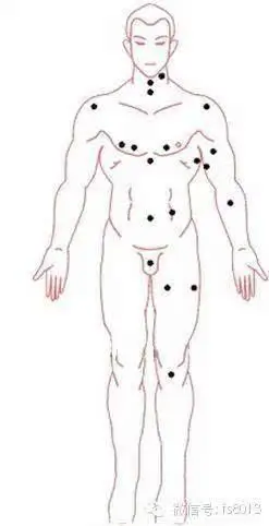 痣长在什么地方好,女孩痣长在什么地方好