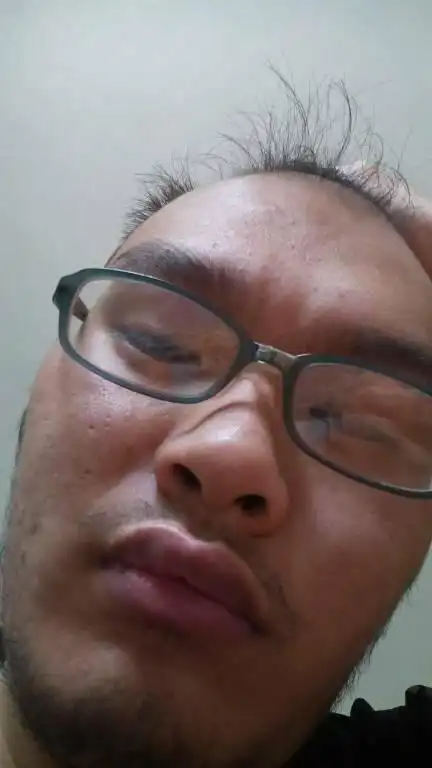 我真的丑么,我可以怎样改变我的外貌,我由先天问题是秃子,麻烦大神们