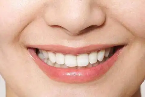 牙齿有缝的人好不好