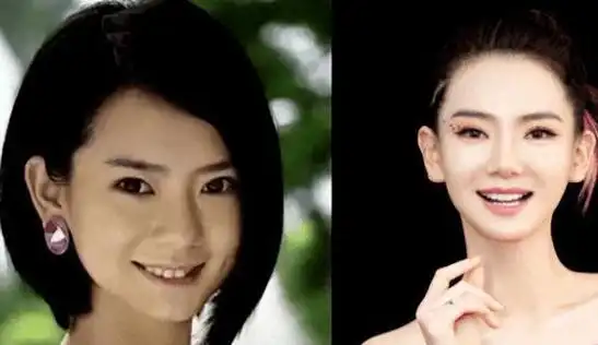 才知眼皮不能跟风割,一刀把灵气都割飞了|戚薇|景甜|整容|双眼皮手术