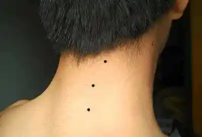 男人脖子后面有痣好不好