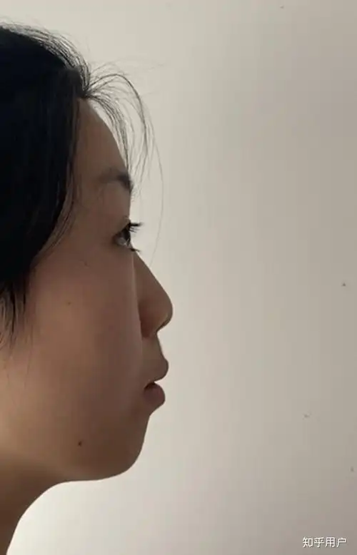 有一个超级扁平的侧脸是一种什么样的体验