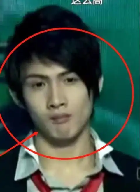 张彬彬早期旧照被扒,截图放大看清他的五官长相,是否整容很显然