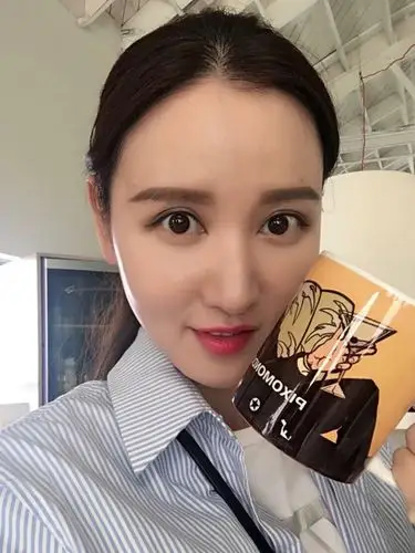 张萌填充过度肿成这样了填充玻尿酸怎么选