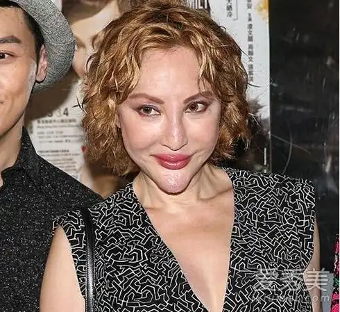 韩国女星鼻子一捏塌了!女星整容后遗症太可怕