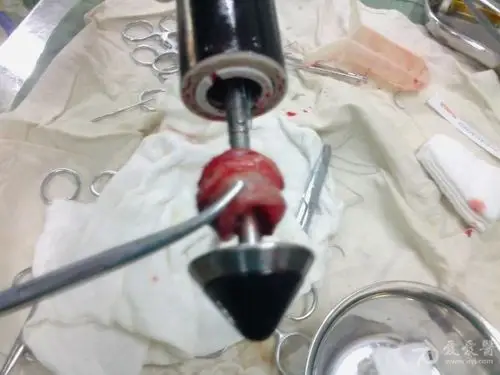 鑫利得重疾先赔付 平安鑫利重疾条款