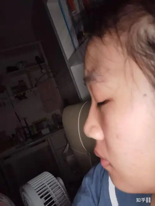没有鼻梁鼻子塌的人是什么体验