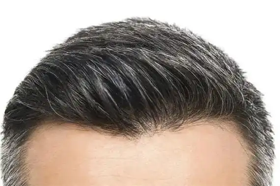 因为发色偏浅,与白发的色差不大,即便染过的发色退色,夹在在头发中的